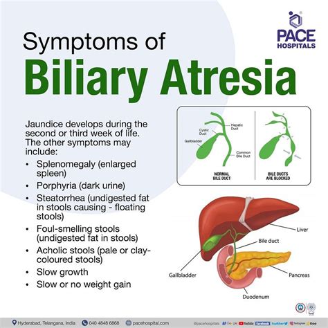 b4il3e leaks|Leaking Bile Duct Symptoms, Causes, Diagnosis, and Treatment